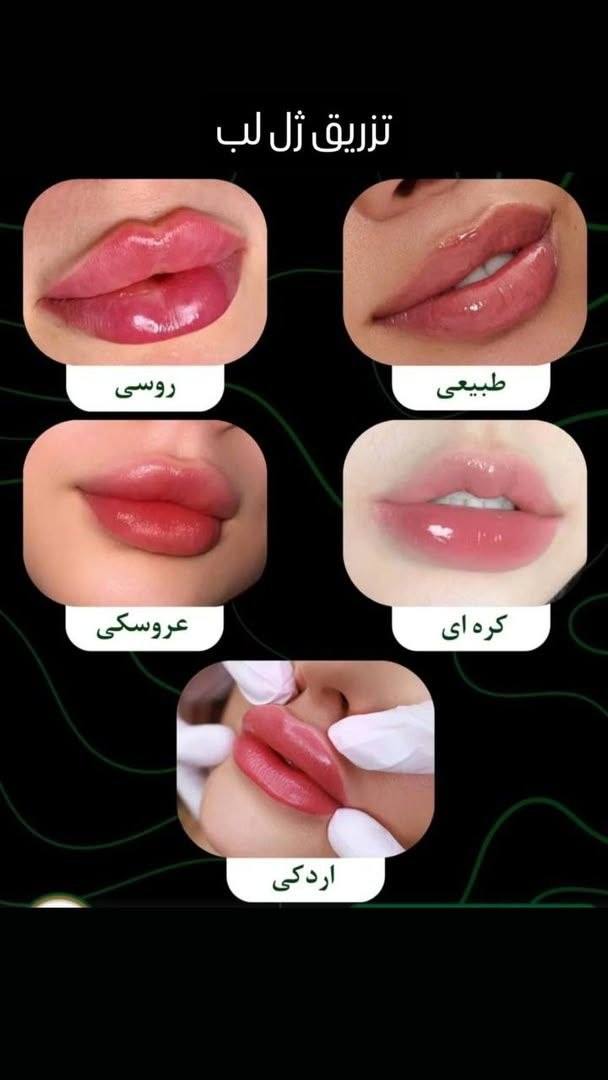 دوکتورس مریم کاظمی